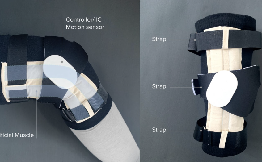 Mixo-suit knee component product anatomy