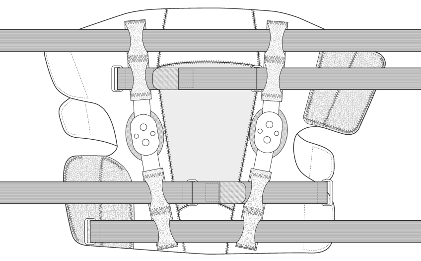 Breg CrossRunner™ Soft Knee Brace technical illustration