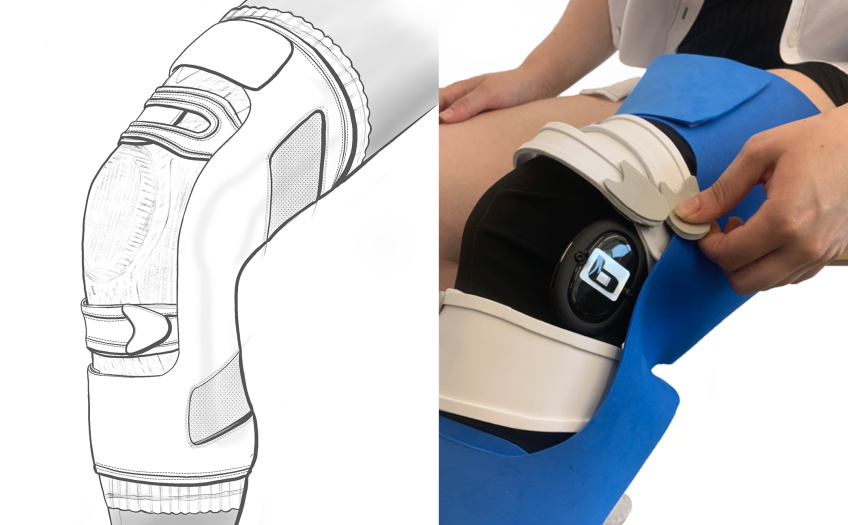 Breg CrossRunner™ Soft Knee Brace illustration and prototype on user